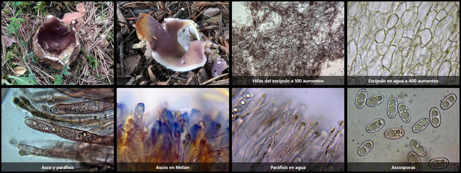 Microscopía de Sarcosphaera coronaria
