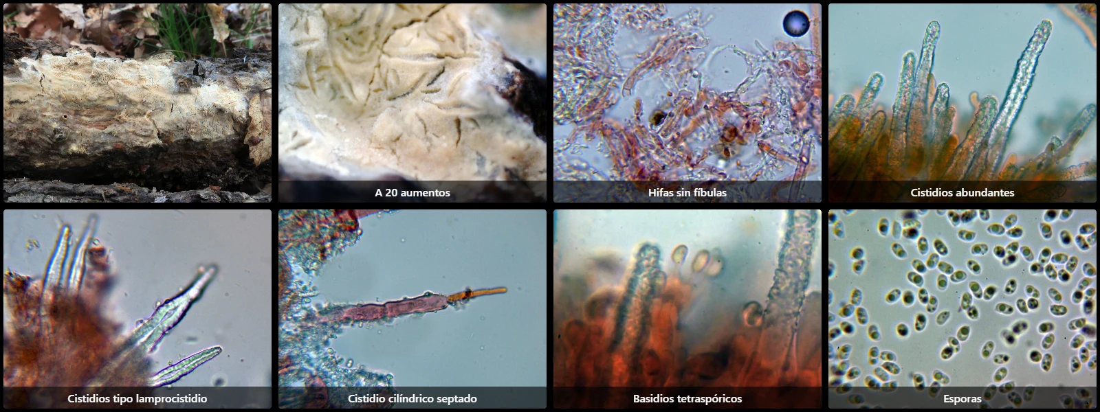 Microscopía de Scopuloides leprosa
