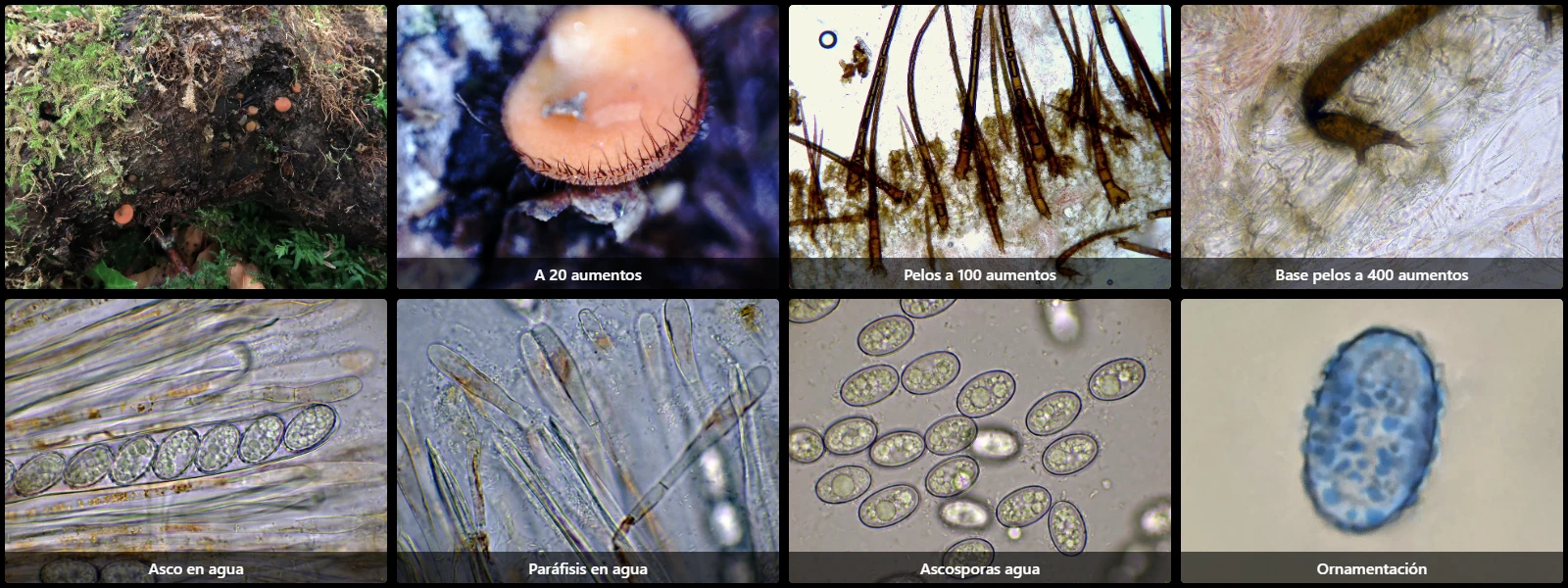 Microscopía de Scutellinia colensoi