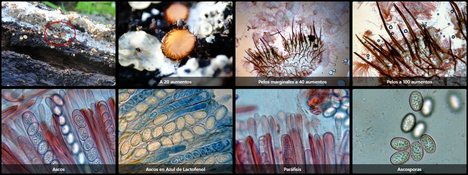 Microscopía de Scutellinia setosa