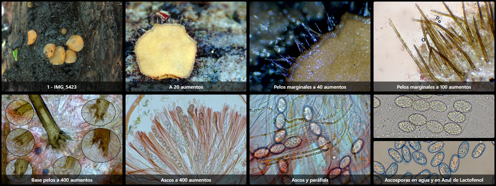 Microscopía de Scutellinia umbrorum
