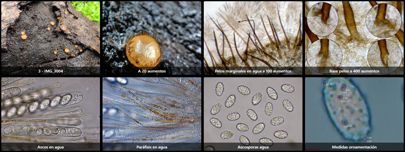 Microscopía de Scutellinia vitreola
