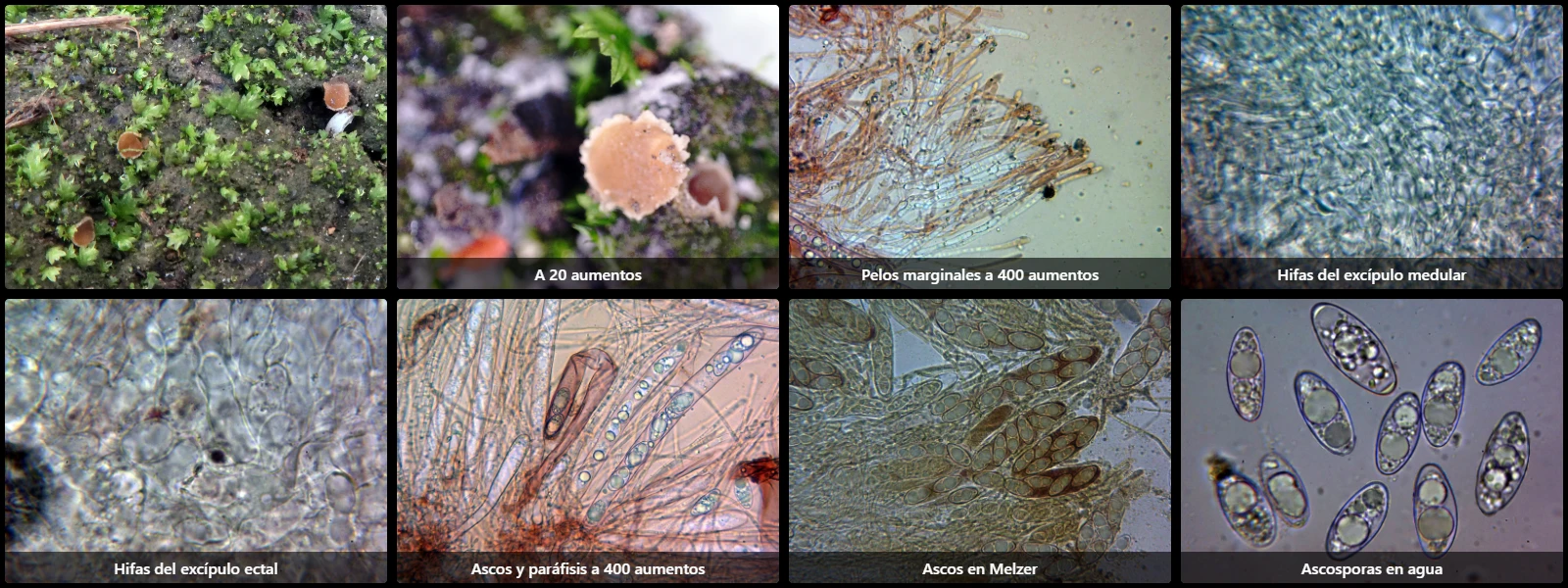 Microscopía de Sepultariella patavina