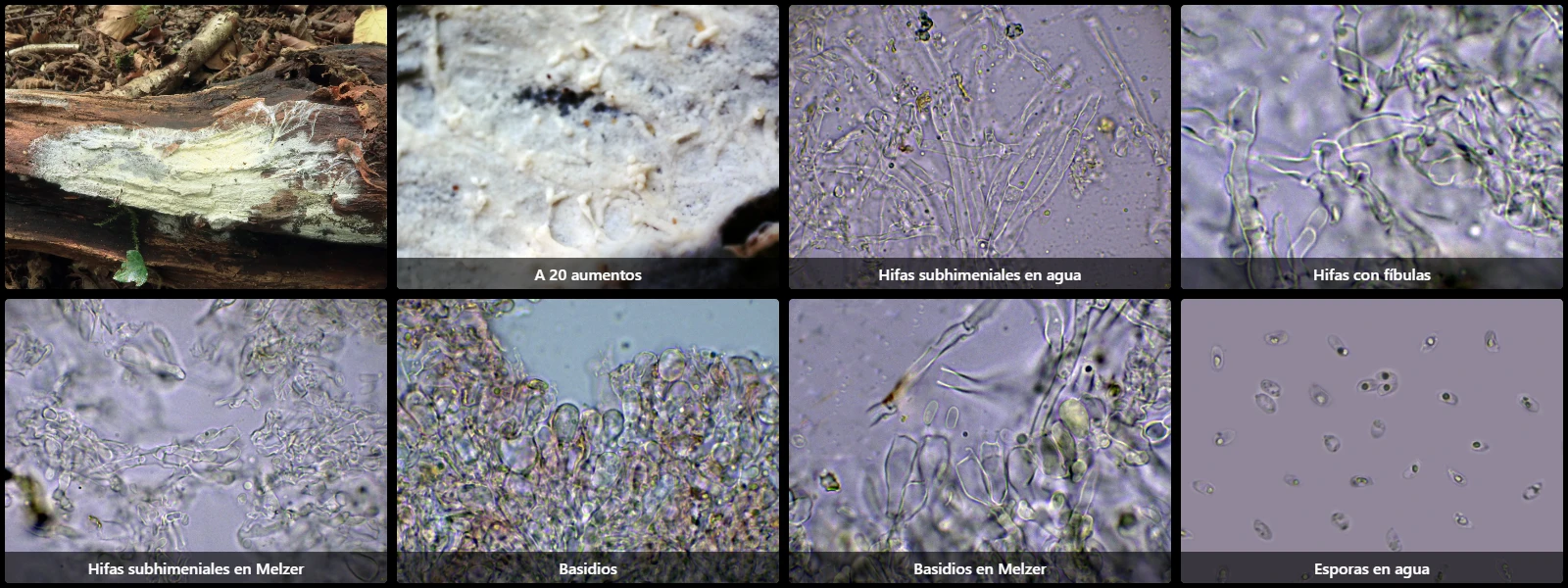Microscopía de Sertulicium granuliferum