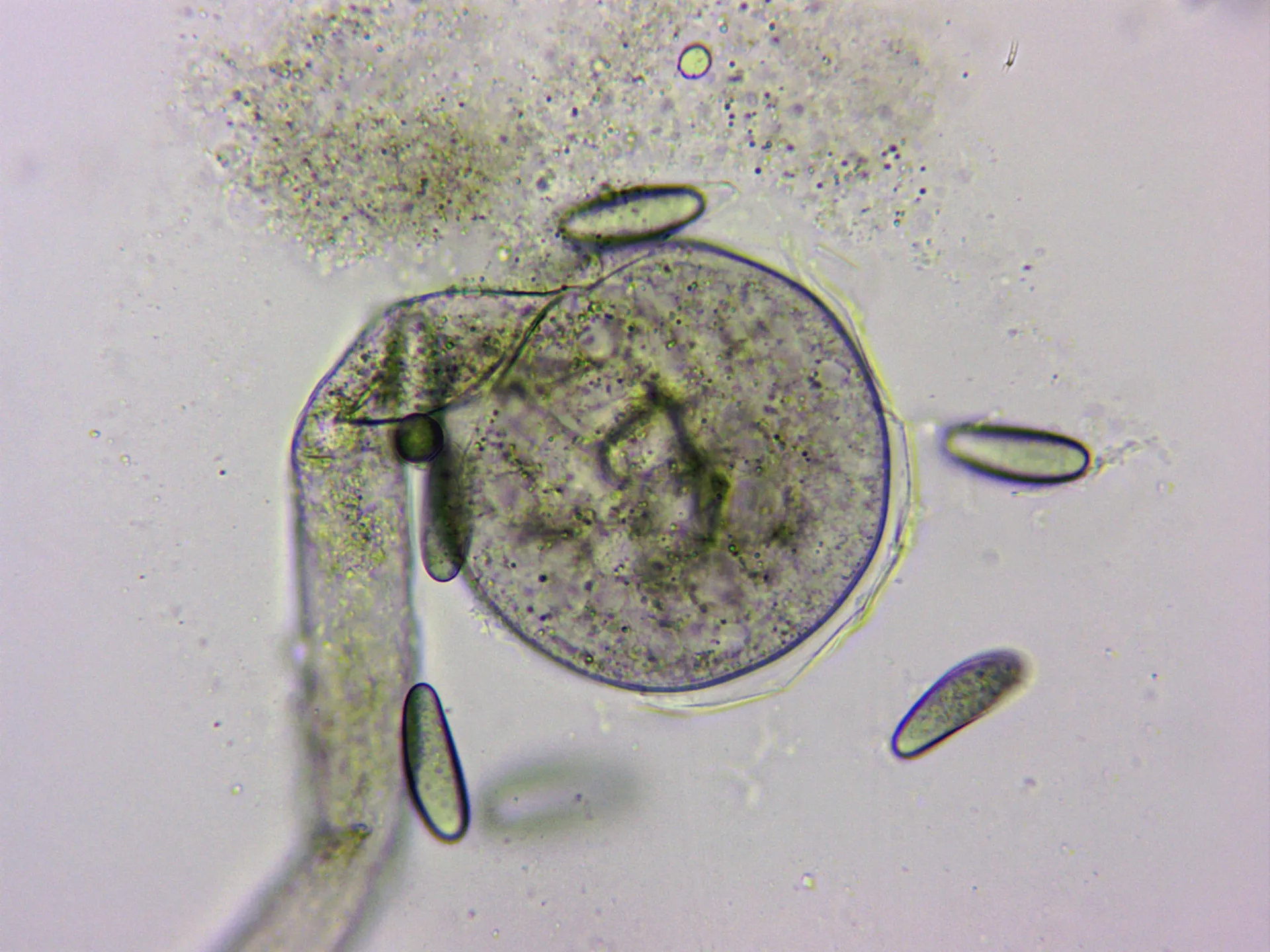 Microscopía de Spinellus fusiger - Esporangio