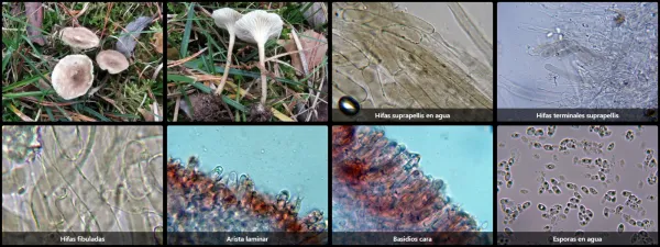 Microscopía de Spodocybe fontqueri
