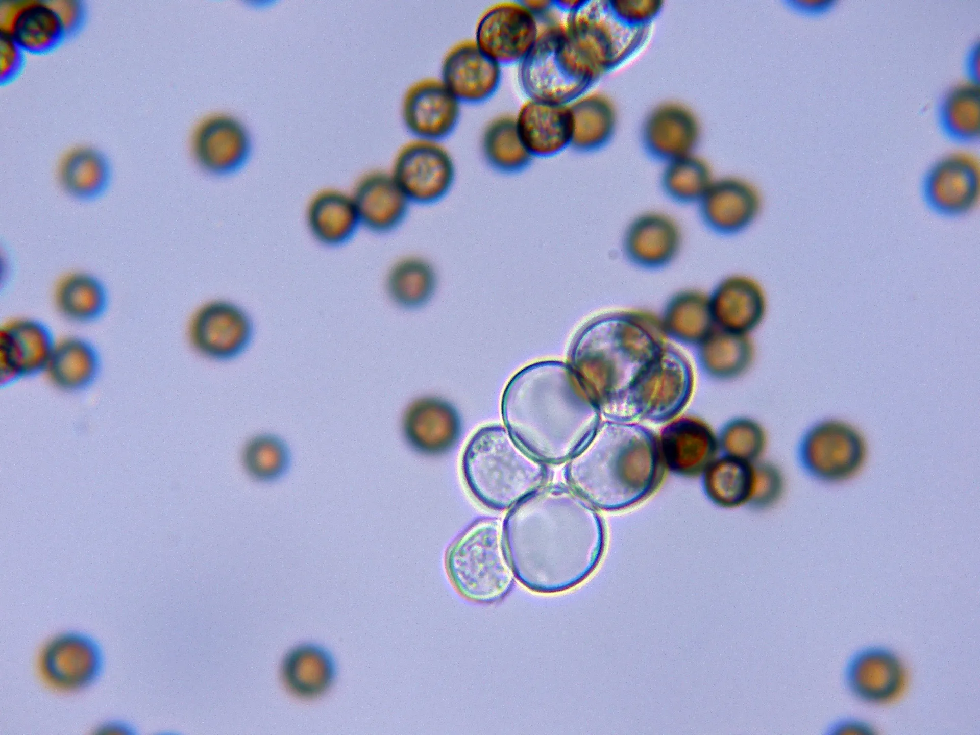 Microscopía de Sporisorium cruentum - 11-002