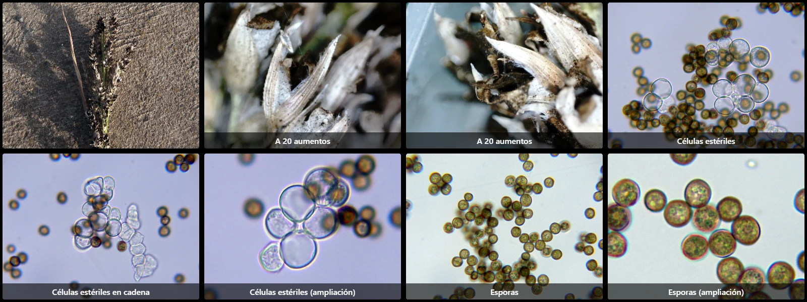 Microscopía de Sporisorium cruentum