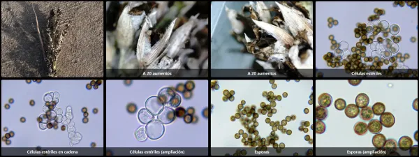 Microscopía de Sporisorium cruentum
