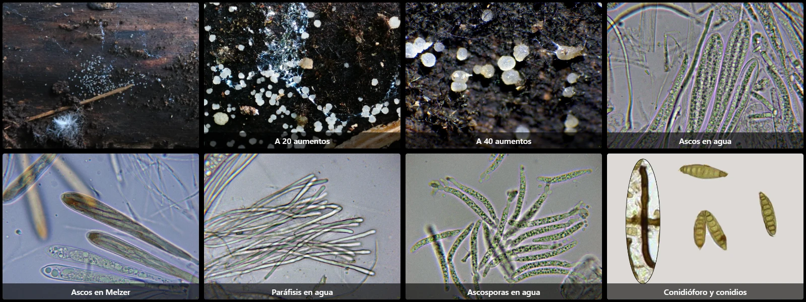 Microscopía de Strossmayeria basitricha