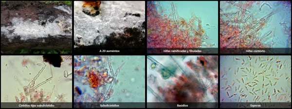 Microscopía de Subulicystidium brachysporum