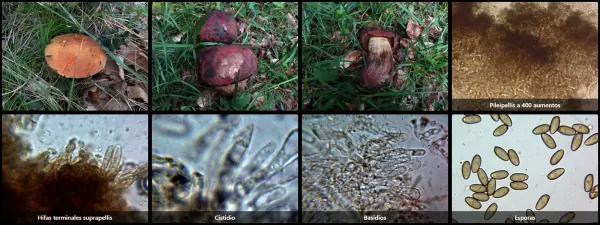 Microscopía de Suillellus queletii