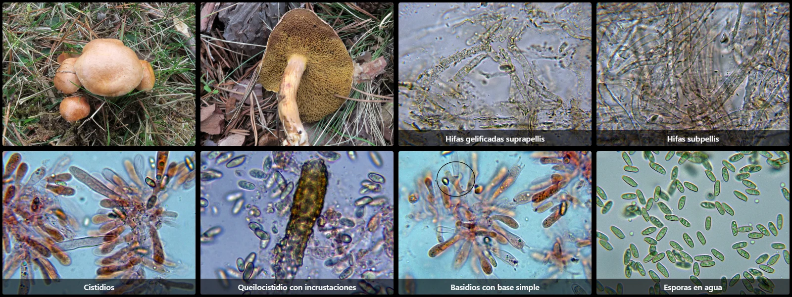 Microscopía de Suillus bovinus