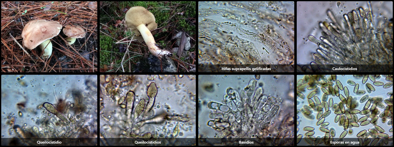 Microscopía de Suillus collinitus