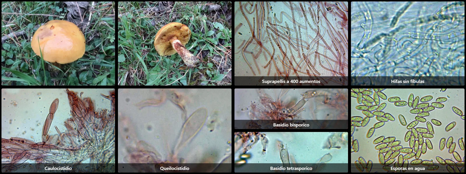 Microscopía de Suillus grevillei