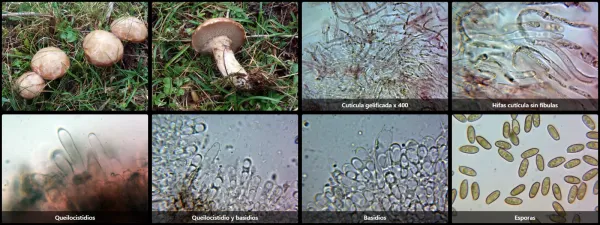 Microscopía de Suillus viscidus