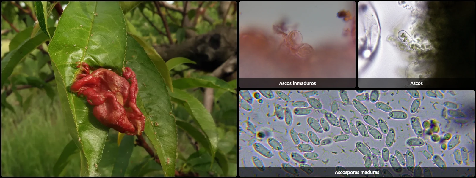 Microscopía de Taphrina deformans