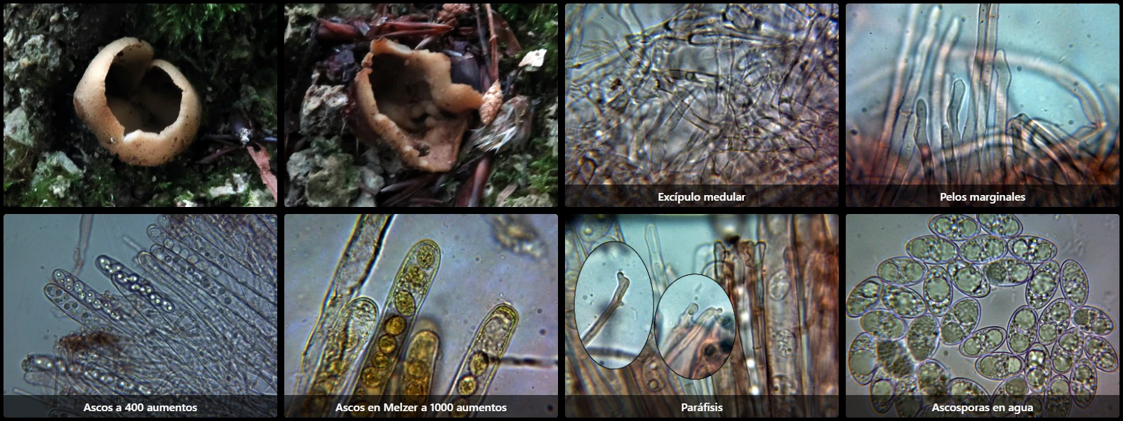 Microscopía de Tarzetta catinus