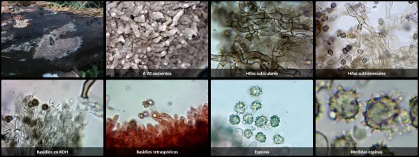 Microscopía de Thelephora wakefieldiae