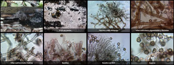 Microscopía de Tomentella griseoviolacea