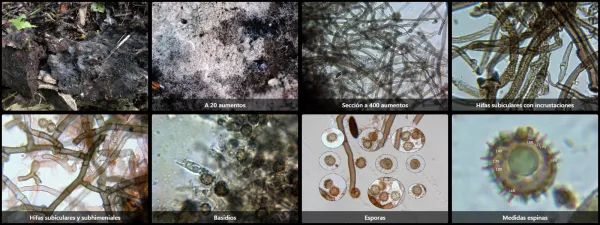 Microscopía de Tomentella lapida