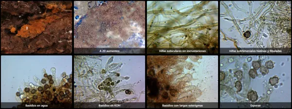 Microscopía de Tomentella lateritia