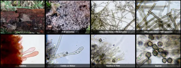 Microscopía de Tomentella muricata