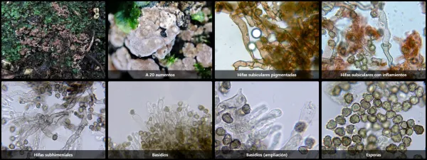 Microscopía de Tomentella radiosa