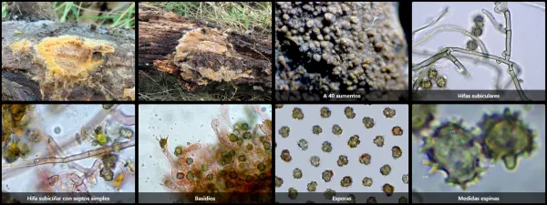 Microscopía de Tomentella testaceogilva