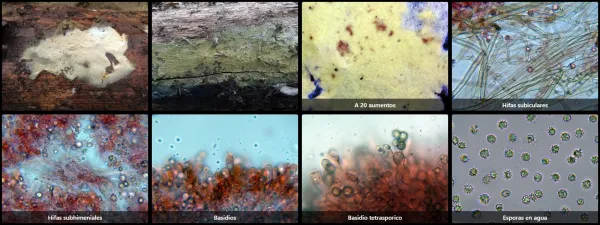 Microscopía de Tomentellopsis echinospora