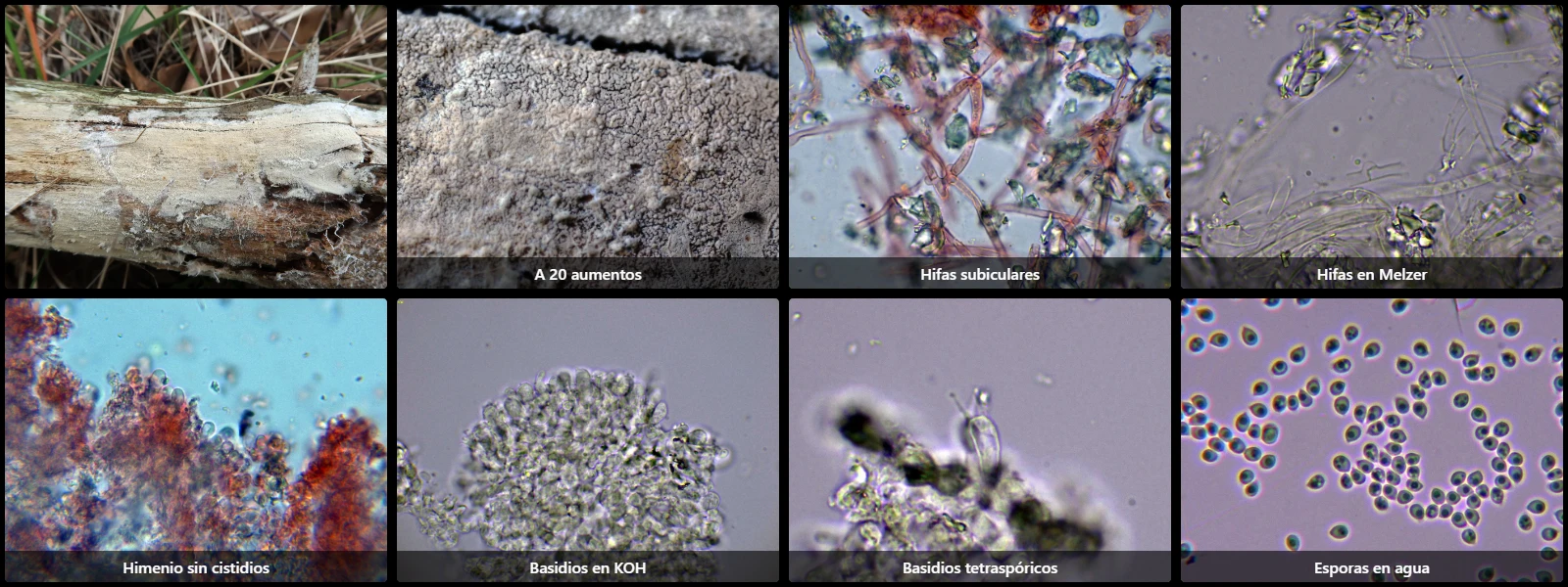 Microscopía de Trechispora cohaerens