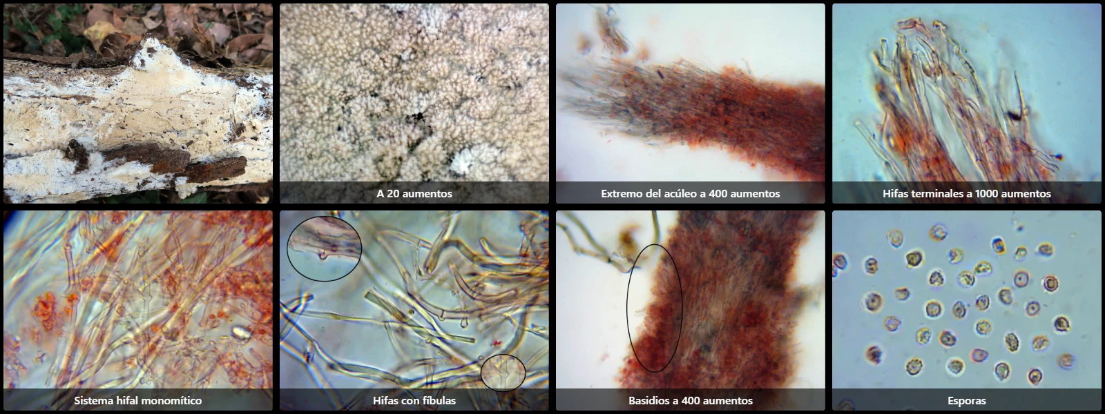 Microscopía de Trechispora farinacea