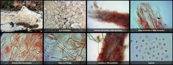 Microscopía de Trechispora farinacea