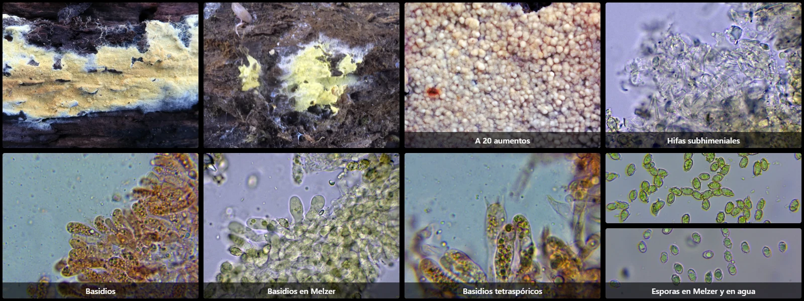 Microscopía de Trechispora fastidiosa