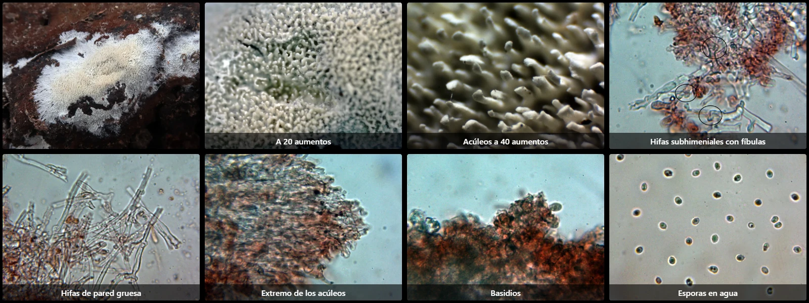 Microscopía de Trechispora kavinioides