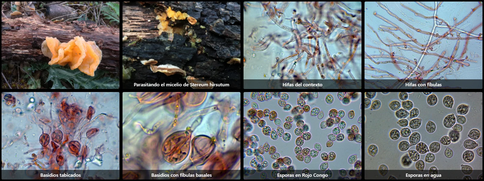 Microscopía de Tremella aurantia