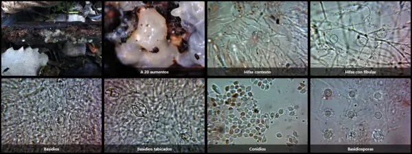 Microscopía de Tremella globispora