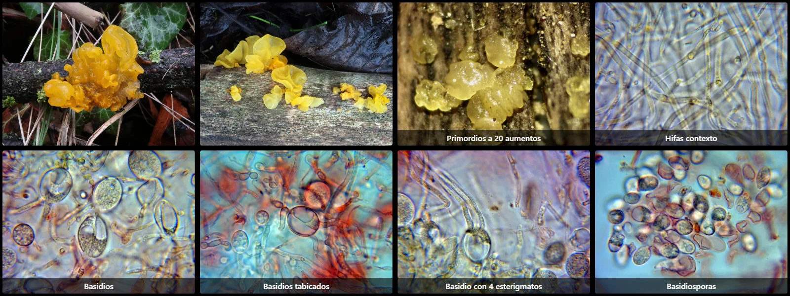 Microscopía de Tremella mesenterica