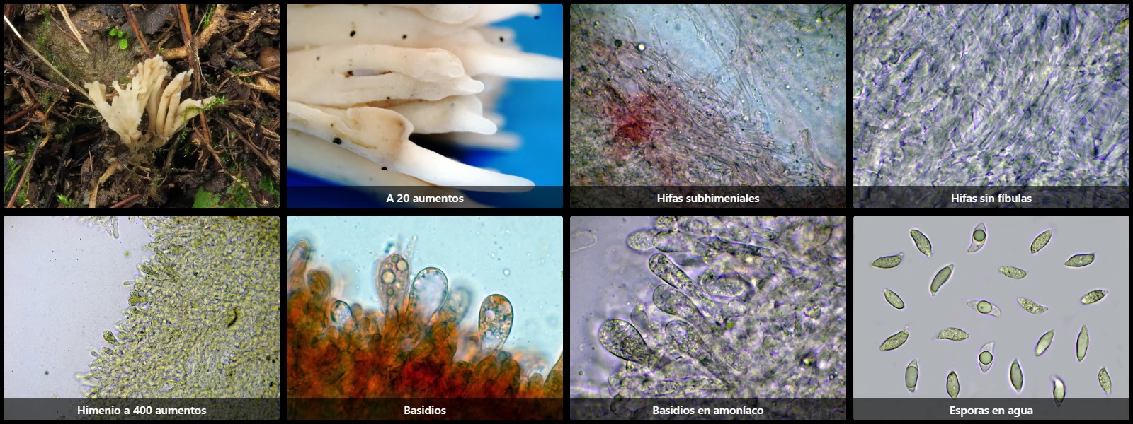 Microscopía de Tremellodendropsis tuberosa