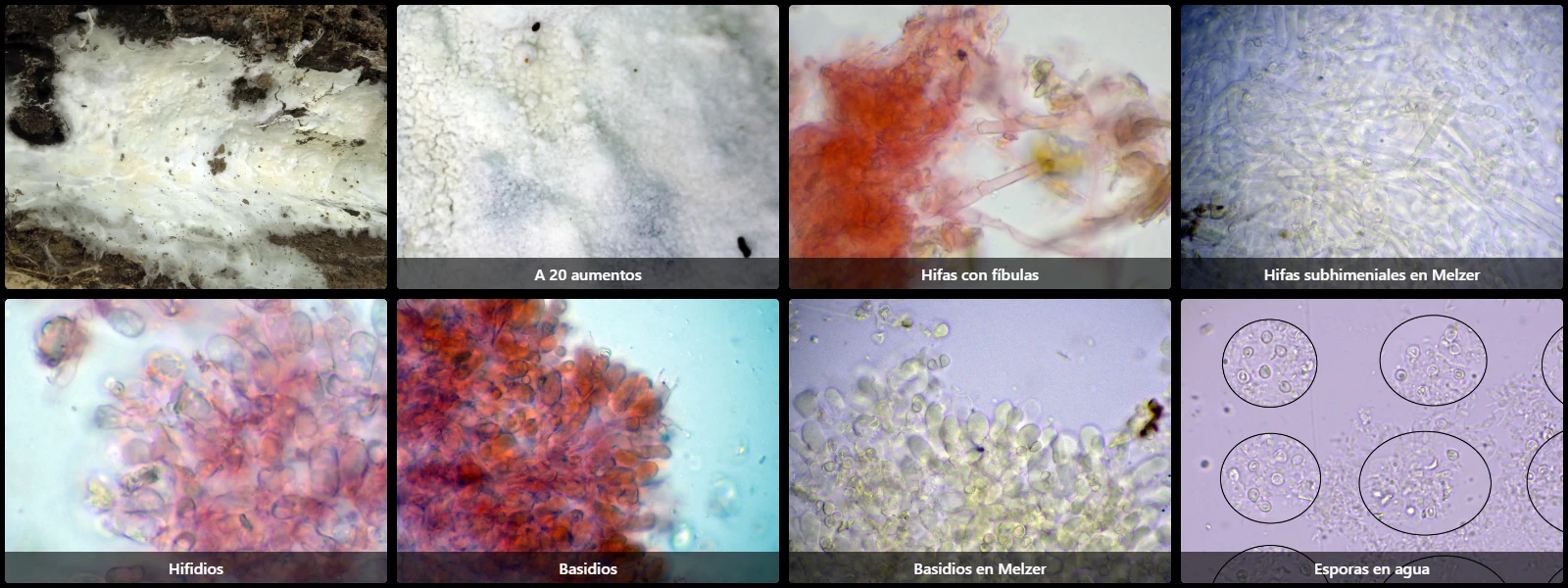 Microscopía de Tretomyces lutescens