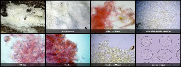 Microscopía de Tretomyces lutescens