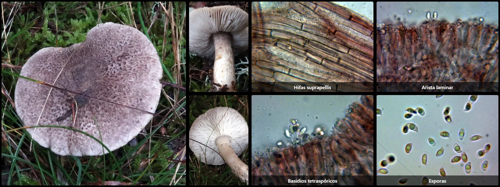 Microscopía de Tricholoma atrosquamosum