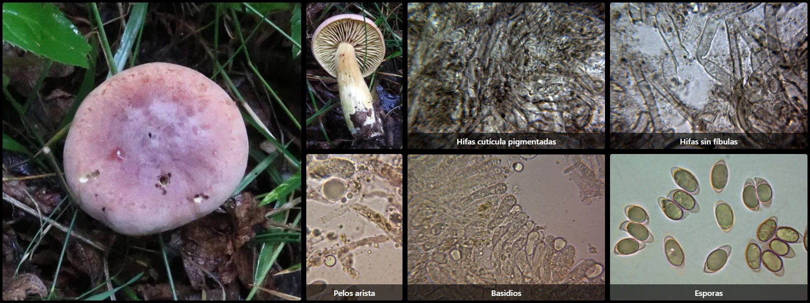 Microscopía de Tricholoma bufonium