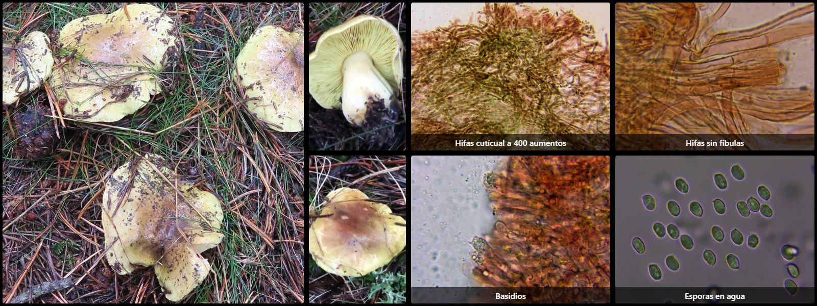 Microscopía de Tricholoma equestre