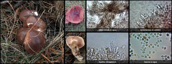 Microscopía de Tricholoma imbricatum