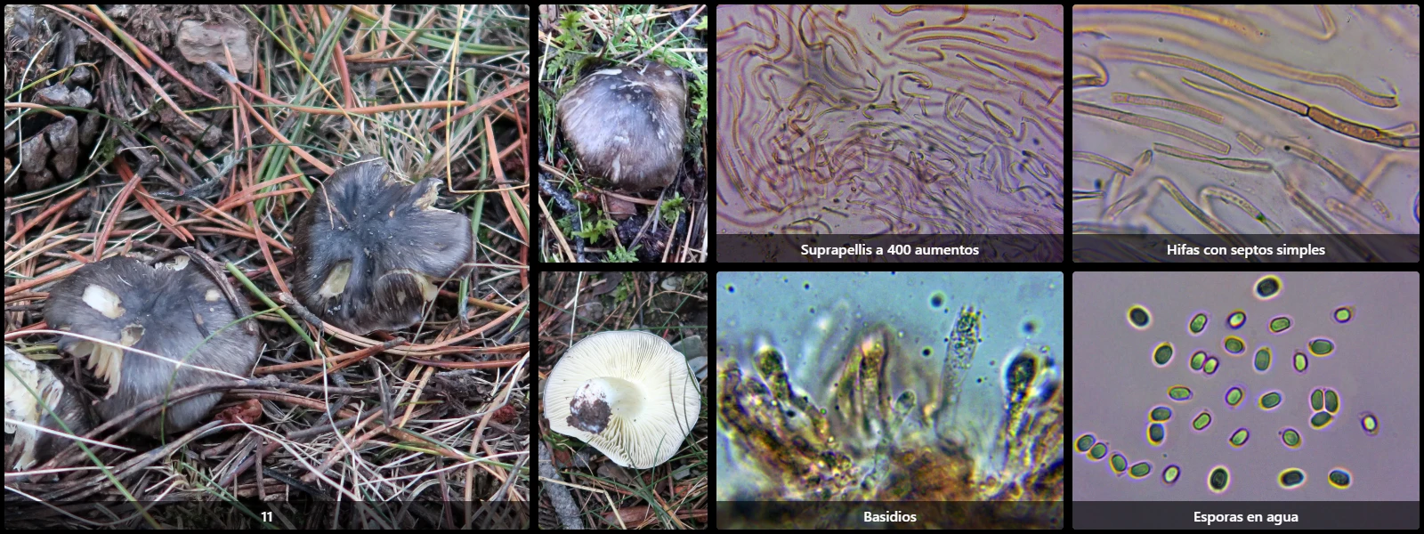 Microscopía de Tricholoma portentosum