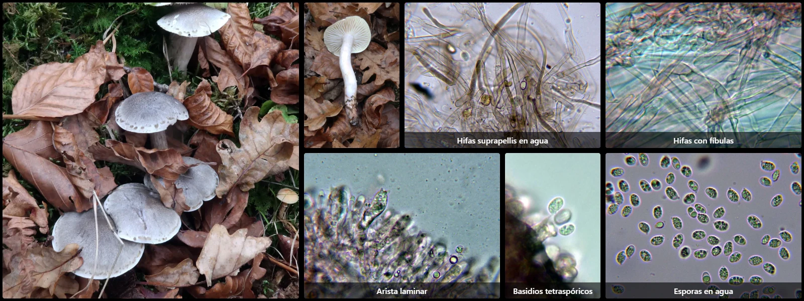Microscopía de Tricholoma saponaceum