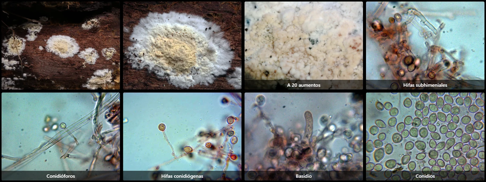 Microscopía de Xenasmatella alnicola