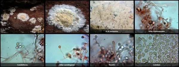 Microscopía de Xenasmatella alnicola