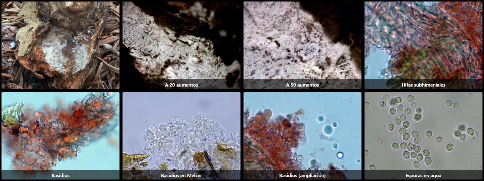 Microscopía de Xenasmatella ardosiaca